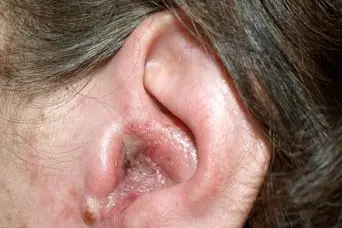 درد، فشار و سردرد؟ این علائم را جدید بگیرید؛ گوش شما در خطر است