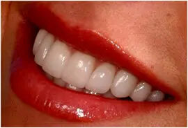 با این روش ها تا آخر عمرت کارت به دندون پزشکی نمیفته