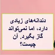 چیستان روز | آن چیست که دندانه‌های زیادی دارد، اما نمی‌تواند گاز بگیرد؟