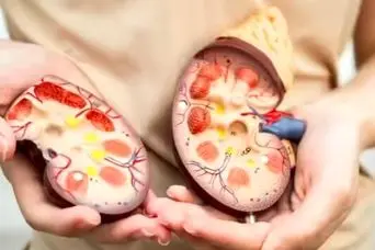 این غذاها کلیه‌های شما را زنده نگه می‌دارند! | خوراکی‌هایی که سلامت کلیه را تضمین می‌کنند