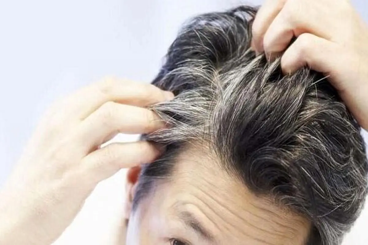 از ظاهر موی سر این ۶ وضعیت سلامتی را شناسایی کنید