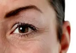 چین و چروک‌ها بر روی صورت شما زیاد شده است ؟ بخوانید
