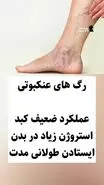 هشدار مهم پزشکان برای همه | این علائم پاها را جدی بگیرید و به دکتر بروید