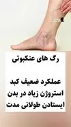 هشدار مهم پزشکان برای همه | این علائم پاها را جدی بگیرید و به دکتر بروید