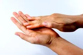  این علامت روی انگشتانتان یعنی بیماری قلبی  دارید | تشخیص بیماری قلبی بدون نیاز به پزشک