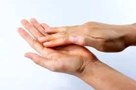  این علامت روی انگشتانتان یعنی بیماری قلبی  دارید | تشخیص بیماری قلبی بدون نیاز به پزشک