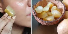 بوتاکس صورت با یخ سیب زمینی