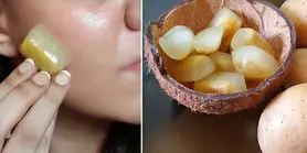 بوتاکس صورت با یخ سیب زمینی