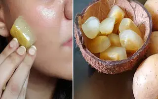 بوتاکس صورت با یخ سیب زمینی