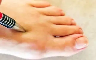با فشار دادن این نقاط از بدن فشار خون خود را فوراً پایین آورید!