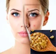 خواص ضدپیری این گیاه ارزشمند؛  لیفت و درخشندگی و جوان‌‌سازی پوست با کندر