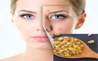 خواص ضدپیری این گیاه ارزشمند؛  لیفت و درخشندگی و جوان‌‌سازی پوست با کندر