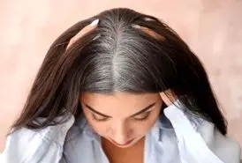  سفیدی زودرس مو را با مصرف این ویتامین درمان کنید 