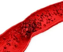  این علائم میگه یه جای بدنت خون لخته شده! 