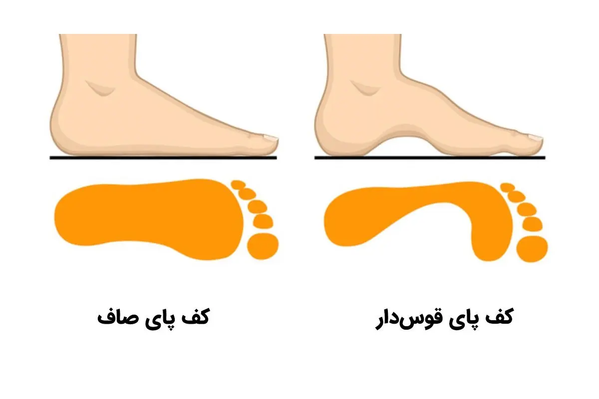 تست شخصیت شناسی | میخوای اطرافیانت رو بهتر بشماسی و رازهاشونو بدونی بگو پاشون چه شکلیه