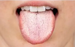 زبانت چه مزه‌ای می‌دهد؟ همین حالا از روی زبانت بیماری‌ات را کشف کن