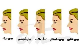تست شخصیت شناسی | به فرم بینی اطرافیانت دقت کنی همه رازاشونو میفهمی