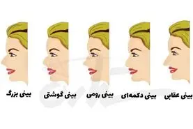 تست شخصیت شناسی | به فرم بینی اطرافیانت دقت کنی همه رازاشونو میفهمی