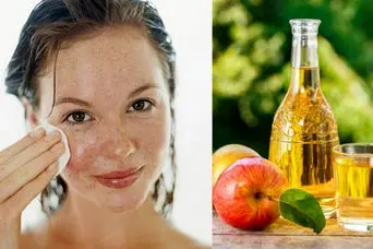 سرکه سیب برای پوست؛ دشمن آکنه و لک‌های پوستی