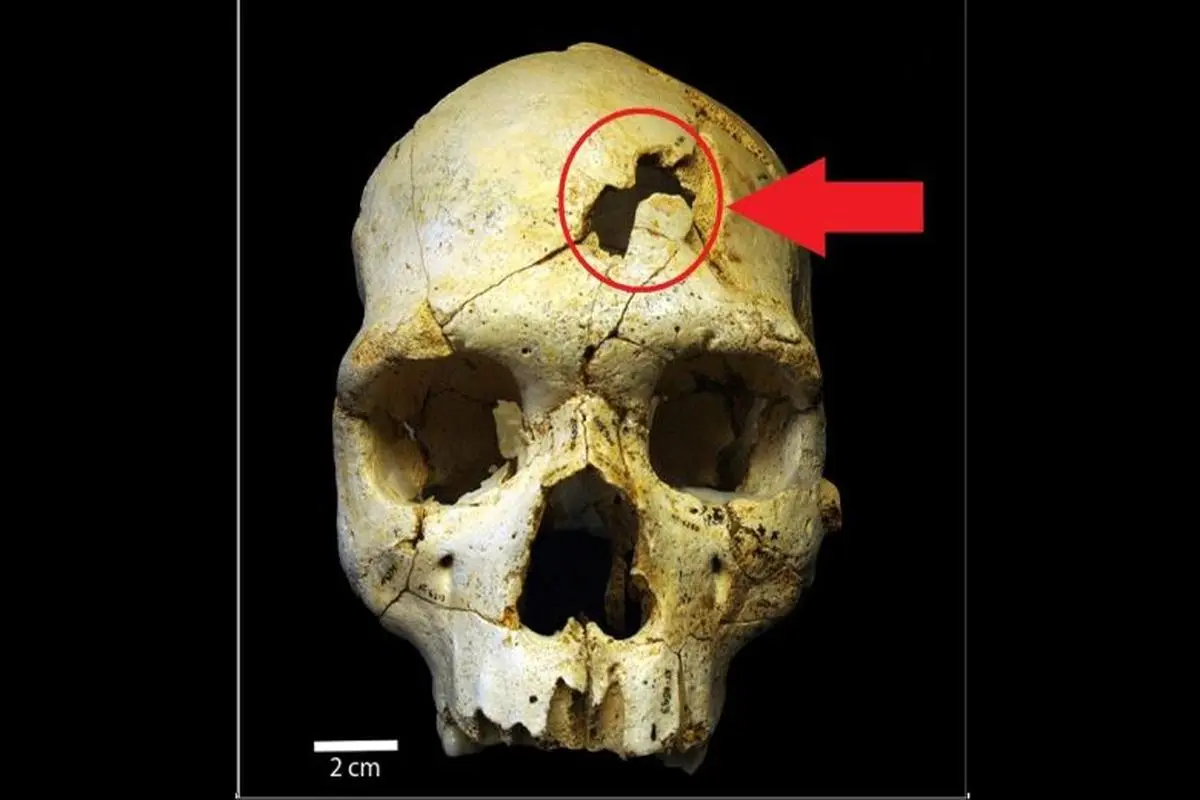 اولین قاتل تاریخ بشریت که بود؟ | کشف جمجمه اولین قاتل و مقتول تاریخ