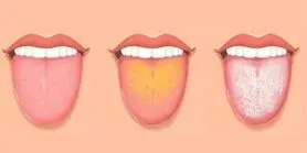 دیگه برای تشخیص بیماری ها نیاز به آزمایش و چکاپ گران قیمت نیست | بگو زبونت چه رنگیه تا تمام مشکلات بدنت رو بگم