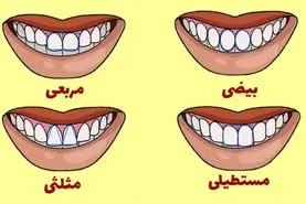 تست شخصیت شناسی | میخوای زیر و بم همه رو بفهمی کافیه به مدل دندوناش دقت کنی