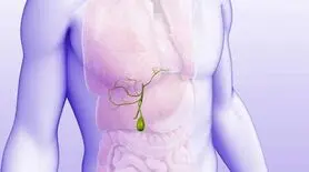 این مواد غذایی کیسه صفراتو نابود میکنه! | تهدید سلامت کیسه صفرا با مصرف چند ماده غذایی