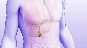 این مواد غذایی کیسه صفراتو نابود میکنه! | تهدید سلامت کیسه صفرا با مصرف چند ماده غذایی
