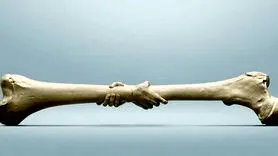  مراقب استخوان‌هایتان باشید | امکان شکستگی استخوان در این افراد بیشتر است 