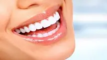می‌خوای دندونات سفید بشن و برق بزنن؟ بیا تا ۸ تا راهکار خونگی بهت یاد بدم