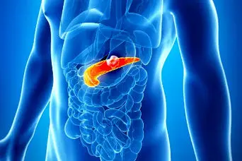 هشدار مرگبار ؛ اگر پاهایتان این ۴ نشانه را دارد،  سرطان پانکراس در کمین است!