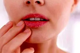 اگر دچار خشکی دهان هستید احتمالا به این بیماری ها مبتلا شده اید