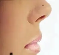  کوچک کردن سریع بینی در خانه با زنجبیل در 10 روز