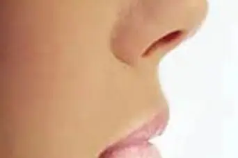  کوچک کردن سریع بینی در خانه با زنجبیل در 10 روز