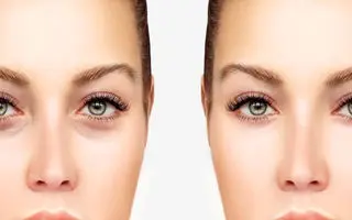 روغن آفتابگردان برای جوانسازی زیر چشم